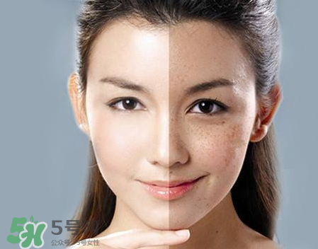 柿子葉凡士林多久祛斑 柿子葉祛斑有人用過嗎 柿子葉凡士林多久祛斑 柿子葉祛斑有人用過嗎