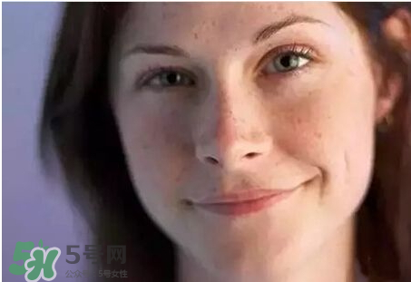 柿子葉凡士林多久祛斑 柿子葉祛斑有人用過嗎 柿子葉凡士林多久祛斑 柿子葉祛斑有人用過嗎