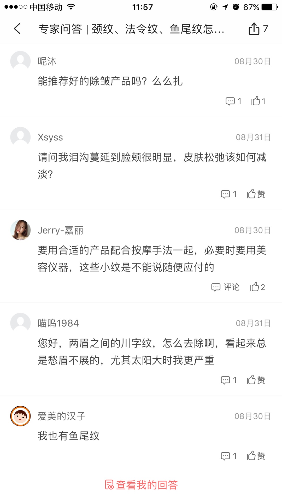 天生的魚尾紋怎么去除或淡化