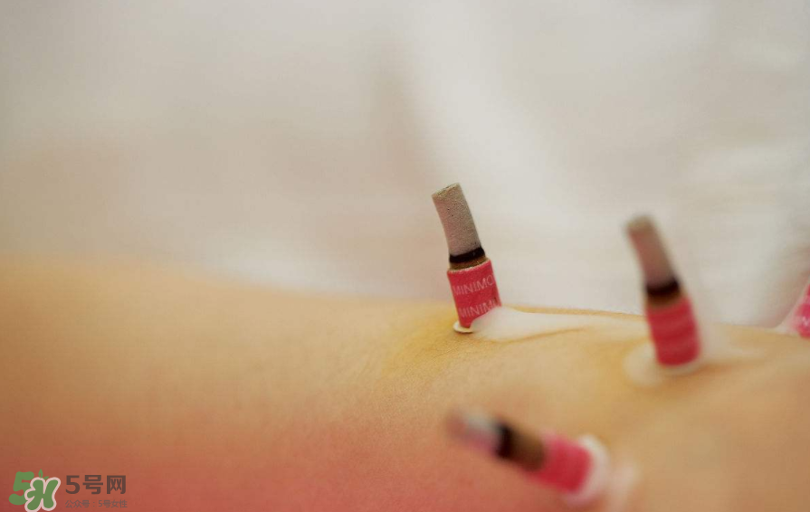 艾灸的時間多少為宜？艾灸后皮膚發(fā)癢是為什么？