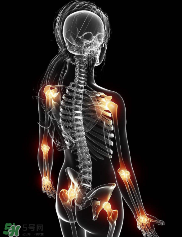 風(fēng)濕要忌口嗎？風(fēng)濕飲食禁忌