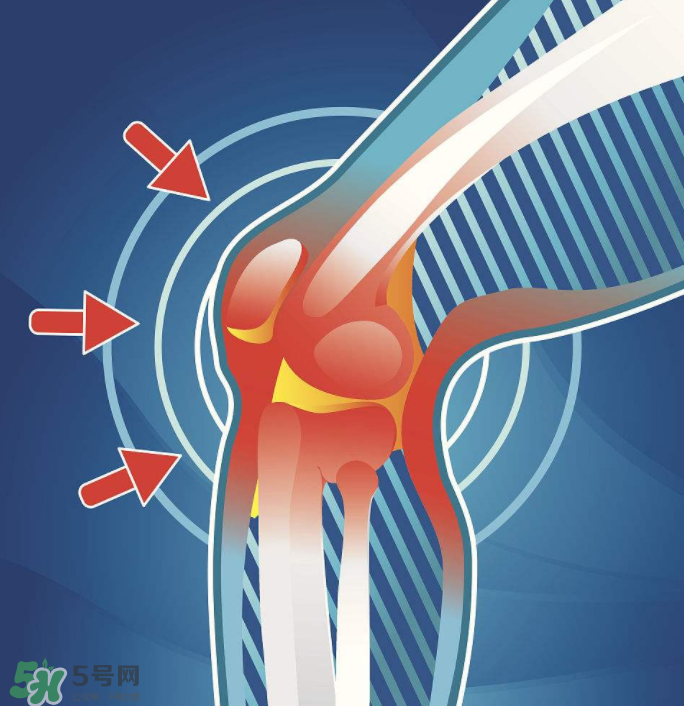 風(fēng)濕要忌口嗎？風(fēng)濕飲食禁忌