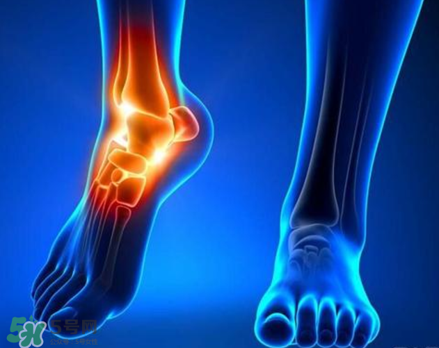 風(fēng)濕要忌口嗎？風(fēng)濕飲食禁忌