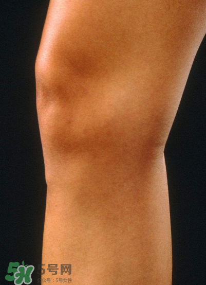 風(fēng)濕要做哪些檢查？風(fēng)濕要檢查哪些項(xiàng)目？