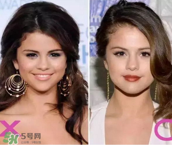 新打耳洞戴什么材質(zhì)的耳釘好？打耳洞用什么消毒最好