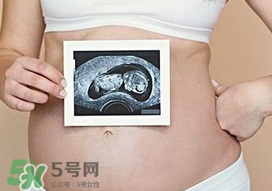 雙子宮可以上環(huán)嗎？雙子宮上環(huán)要注意哪些？