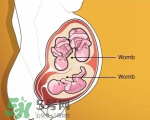 雙子宮是什么意思？雙子宮可以順產(chǎn)嗎？