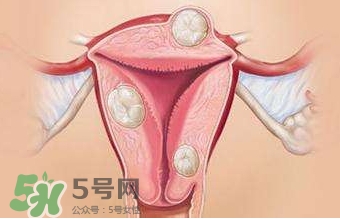 雙子宮可以上環(huán)嗎？雙子宮上環(huán)要注意哪些？