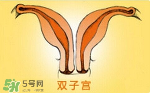 雙子宮是什么意思？雙子宮可以順產(chǎn)嗎？