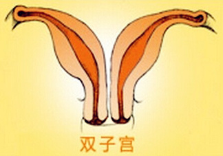 雙子宮是什么意思？雙子宮可以順產(chǎn)嗎？