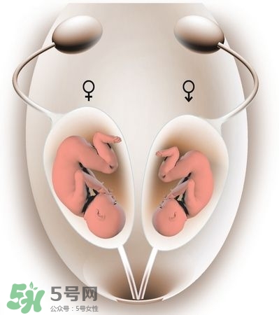 雙子宮對懷孕有影響嗎？雙子宮懷孕要注意什么？