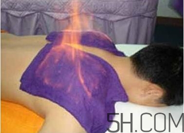 火療真的能治病嗎？火龍液的功效與作用