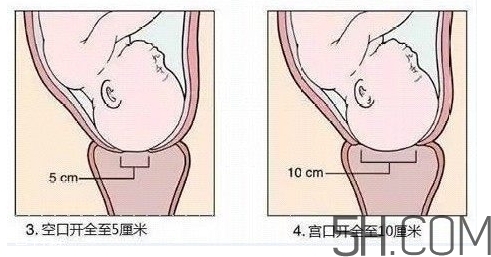 內(nèi)檢是什么感覺？內(nèi)檢有男醫(yī)生嗎？