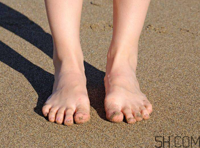 腳氣會引起灰指甲嗎？腳氣加灰指甲怎么治？