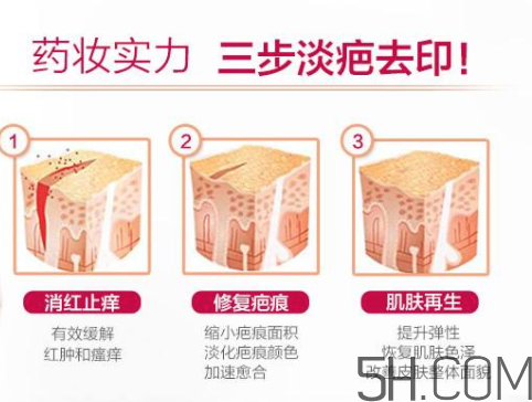 ISDIN怡思丁祛疤膏怎么用？ISDIN怡思丁祛疤膏使用說明