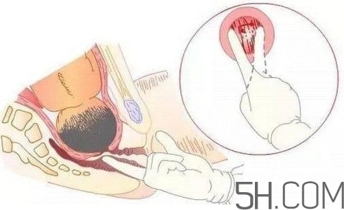 內(nèi)檢是什么感覺？內(nèi)檢有男醫(yī)生嗎？