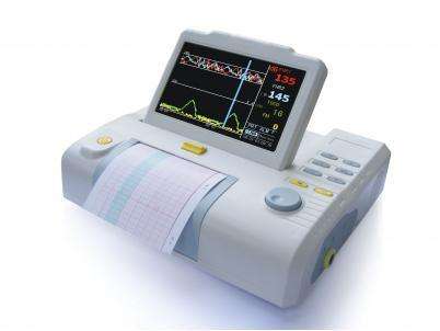 胎心監(jiān)護(hù)圖怎么看？胎心監(jiān)護(hù)多少錢？