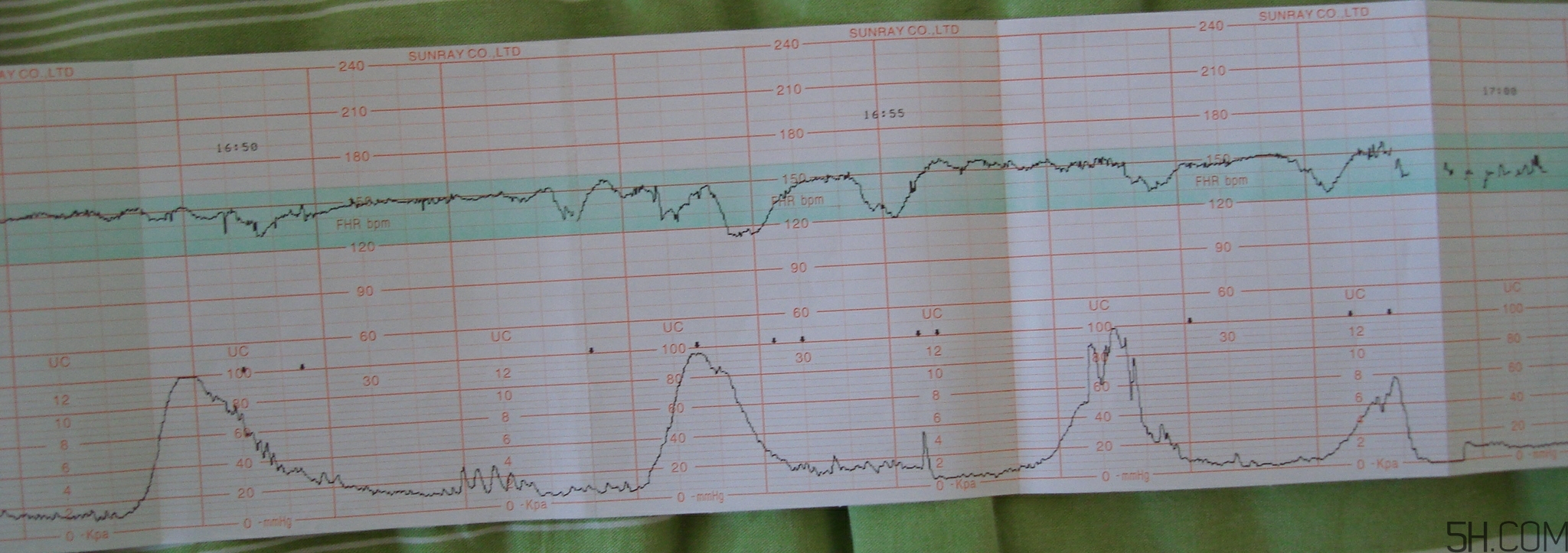 為什么要做胎心監(jiān)護(hù)？孕婦做胎心監(jiān)護(hù)有什么用？