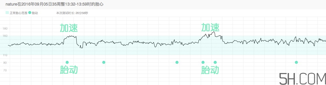 為什么要做胎心監(jiān)護(hù)？孕婦做胎心監(jiān)護(hù)有什么用？