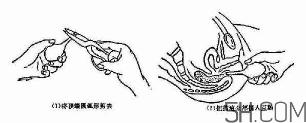 開塞露怎么用？開塞露用后多久會排便？