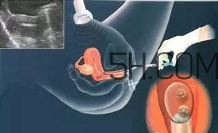 試管嬰兒有什么風(fēng)險？試管嬰兒長大后的弊端