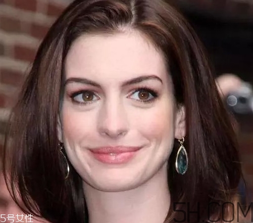 頭虱和頭皮屑怎么區(qū)分？頭虱是怎樣生成的