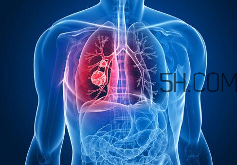 哮喘會(huì)頭暈嗎？哮喘會(huì)引起一直頭暈嗎？