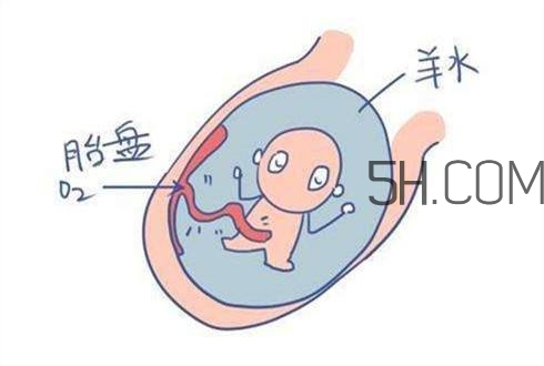 怎么防止羊水早破？羊水早破的危害