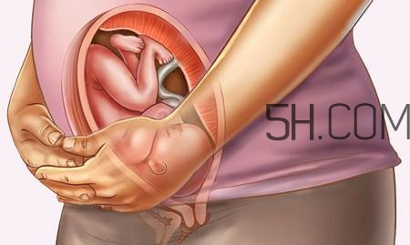 怎么防止羊水早破？羊水早破的危害