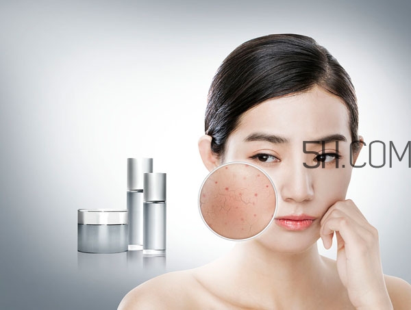 經(jīng)前暗瘡吃什么好 經(jīng)前暗瘡怎么調理