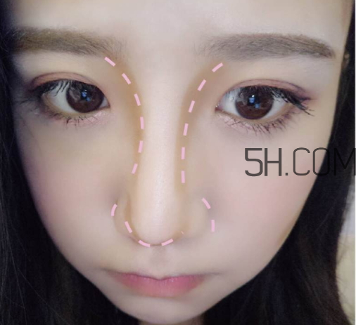 恒芳修容棒好用嗎？恒芳修容棒怎么樣？