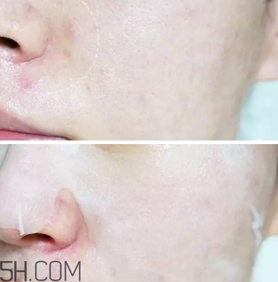 百元補水護膚品哪個牌子好？百元左右換季補水護膚品推薦