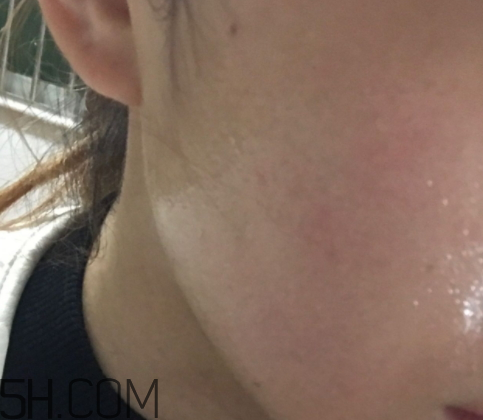 新生活國際玻尿酸補(bǔ)水面膜怎么樣？多少錢？