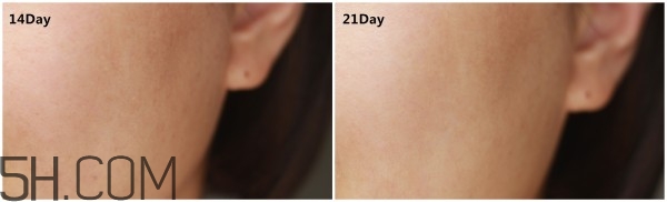 蘭蔻小黑瓶安瓶精華和雅詩蘭黛小棕瓶精華哪個好?