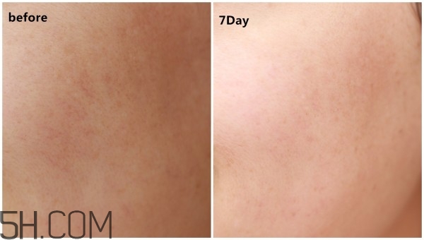 蘭蔻小黑瓶安瓶精華和雅詩蘭黛小棕瓶精華哪個好?