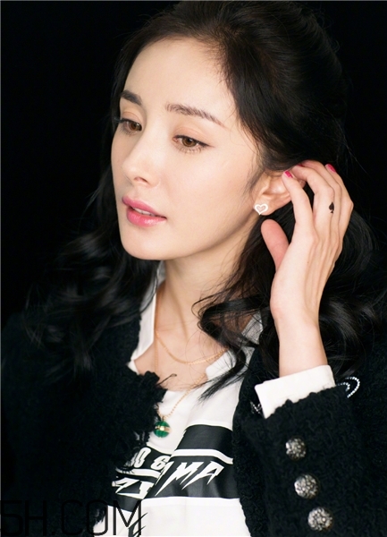 黃褐斑跟飲食有關(guān)系嗎？黃褐斑跟養(yǎng)狗有關(guān)嗎？