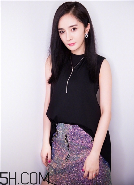 黃褐斑跟飲食有關(guān)系嗎？黃褐斑跟養(yǎng)狗有關(guān)嗎？