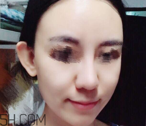 京潤珍珠玻尿酸面膜怎么樣？多少錢？