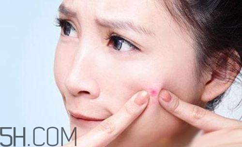 泊美祛痘系列怎么樣？泊美祛痘系列有哪些？