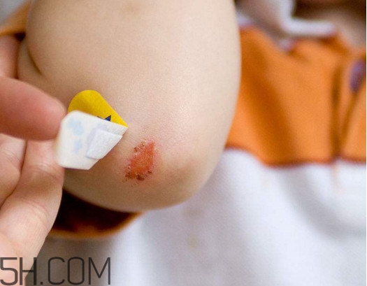 創(chuàng)可貼有消炎作用嗎？一張創(chuàng)可貼能用多長時(shí)間