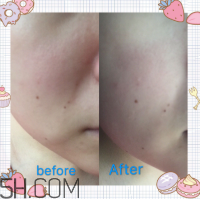 歐珀萊臻白多效角質(zhì)調(diào)理肌底液怎么樣？好用嗎？