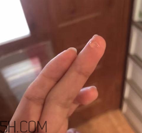 倍舒痕可以去痘印嗎？倍舒痕能涂在痘痘上嗎？