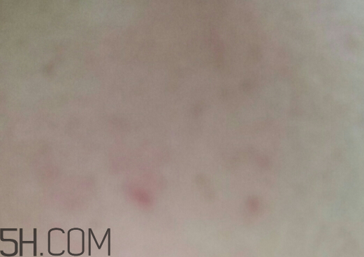 aox suaox祛痘原液怎么樣？多少錢(qián)？