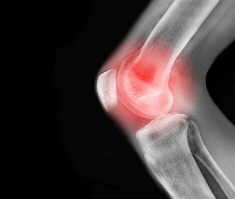 關(guān)節(jié)炎能吃螃蟹嗎？關(guān)節(jié)炎能吃海鮮嗎？