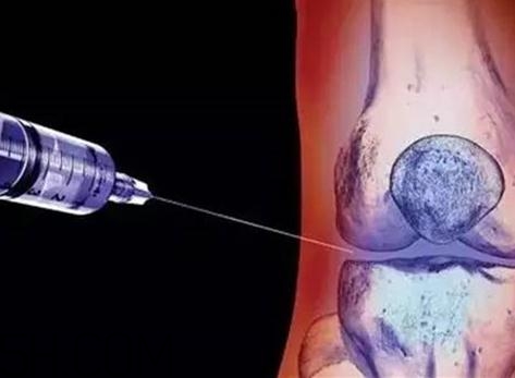 關(guān)節(jié)炎打封閉針好嗎？關(guān)節(jié)炎打封閉針有副作用嗎？