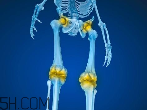 關(guān)節(jié)炎積液什么癥狀？關(guān)節(jié)炎積水怎么治療？