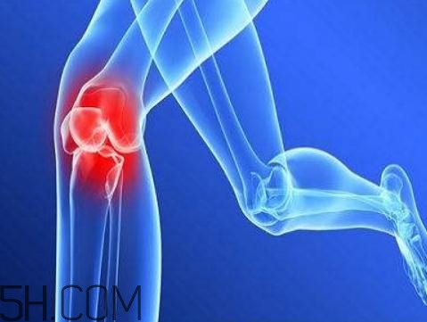 關節(jié)炎需要補鈣嗎？關節(jié)炎補鈣有用嗎？