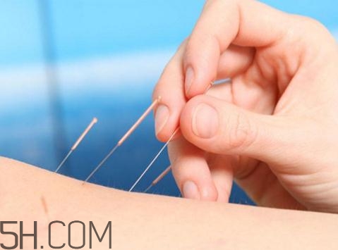 關節(jié)炎需要補鈣嗎？關節(jié)炎補鈣有用嗎？