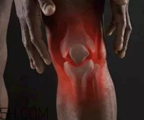 關(guān)節(jié)炎可以拔火罐嗎？關(guān)節(jié)炎拔罐管用嗎？