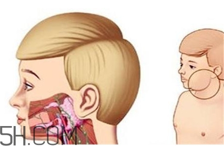 淋巴癌最嚴(yán)重時(shí)會成什么樣子？淋巴瘤能治好嗎